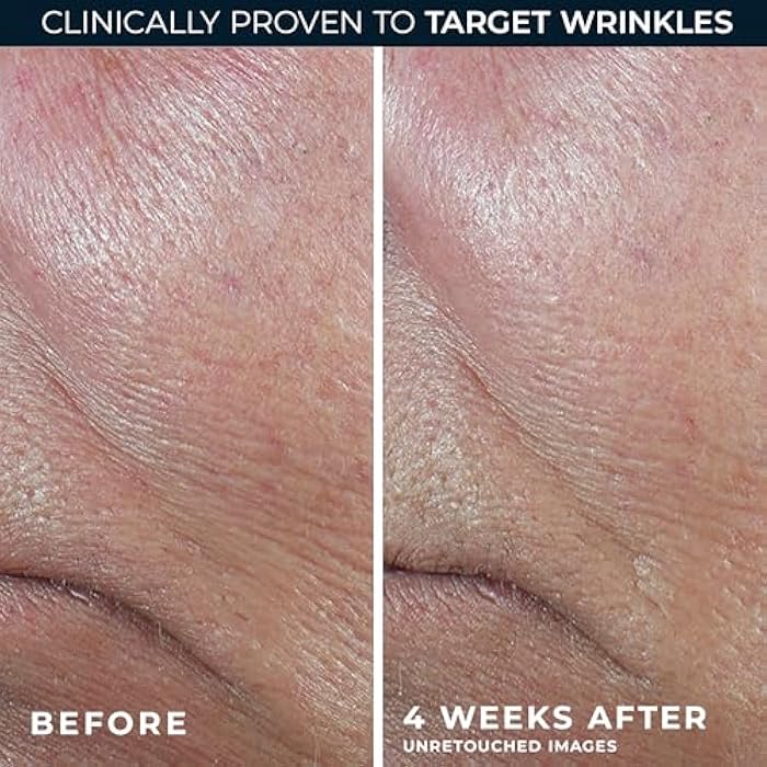 RoC Derm Correxion Retinol Firming Serum Stick with Antioxidants to Visibly Tighten and Firm Wrinkles and Laugh Lines 1.0 oz plus Retinol Eye Cream Packette - Image 5